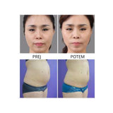 Mini hifu naprava 6v1