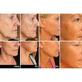 Plasma ART za nego obraza