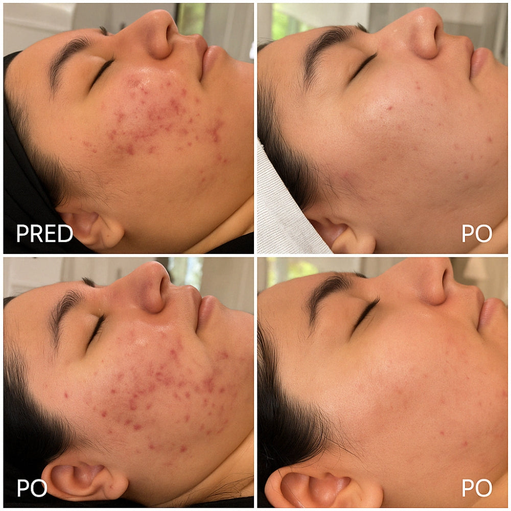 Plasma ART za nego obraza