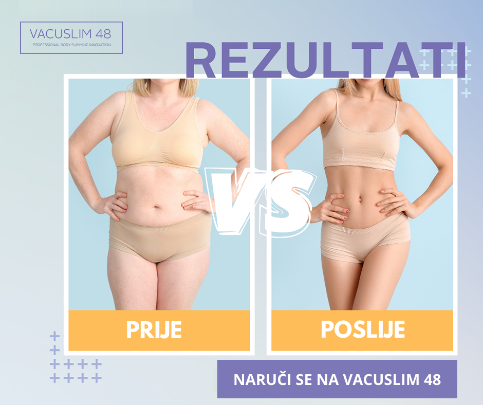 VACUSLIM 4 YOU - paket za oblikovanje postave doma