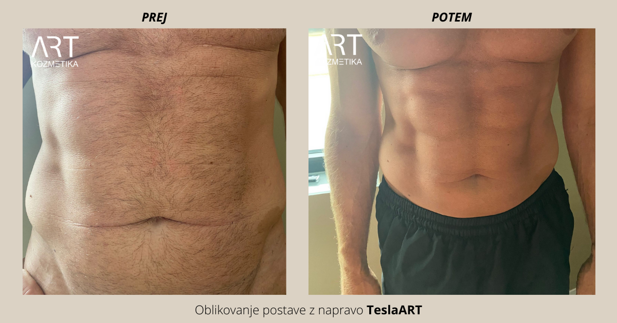 rezultati uporabnikov