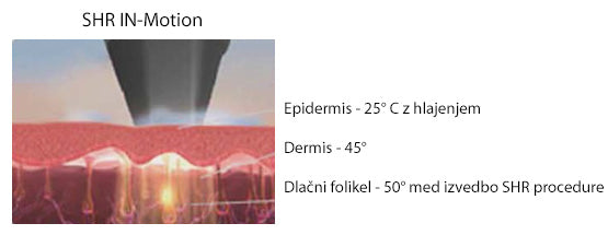 prikaz delovanja eLite Ana SHR