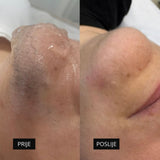 Diodni laser TrisCAM - najem