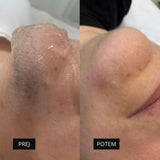 Diodni laser TrisCAM