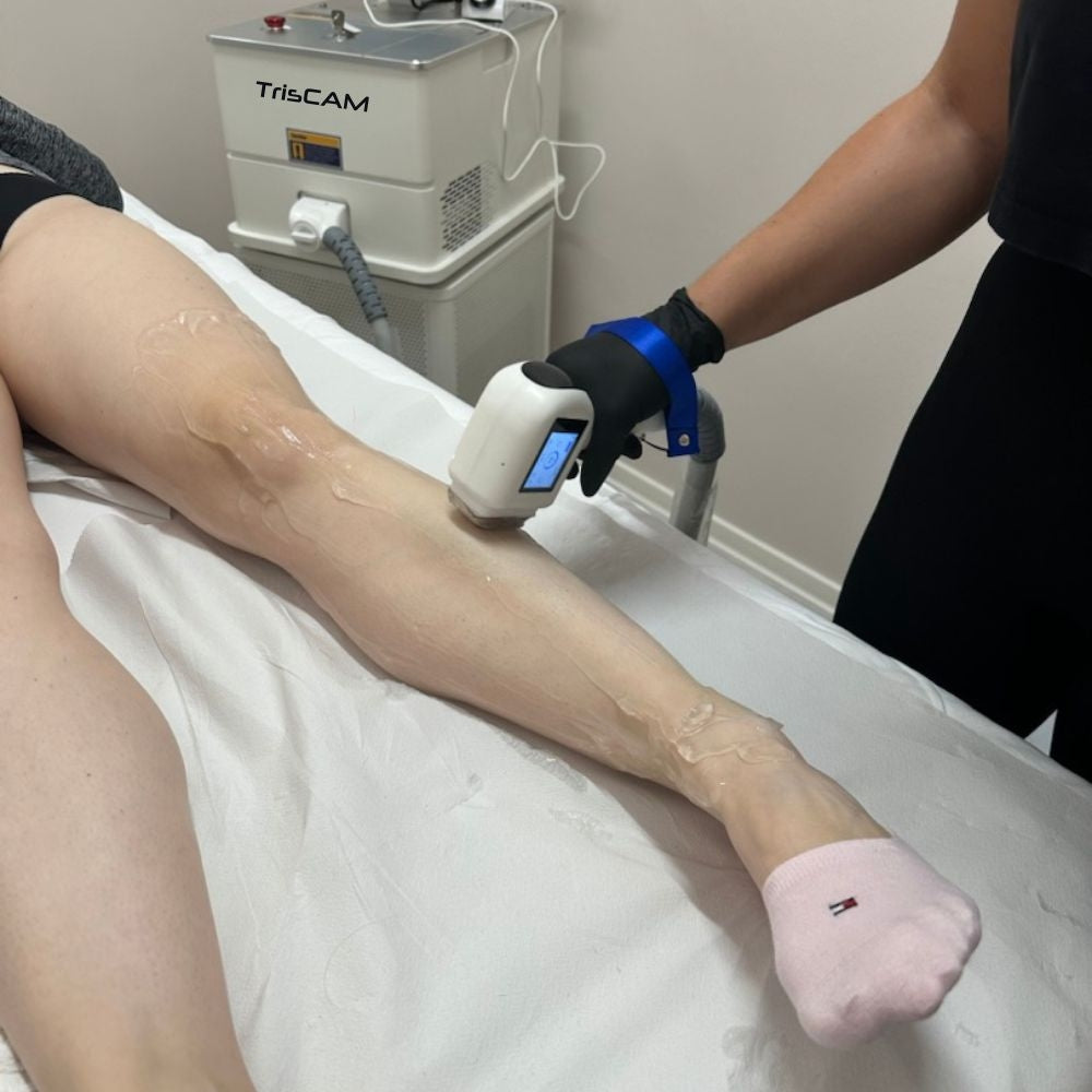 Diodni laser TrisCAM