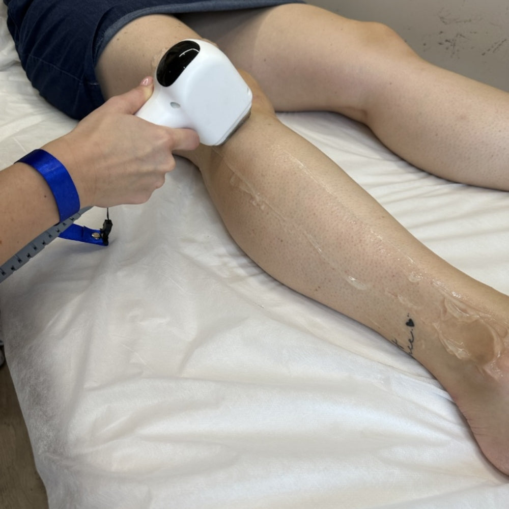 Diodni laser TrisCAM - najem