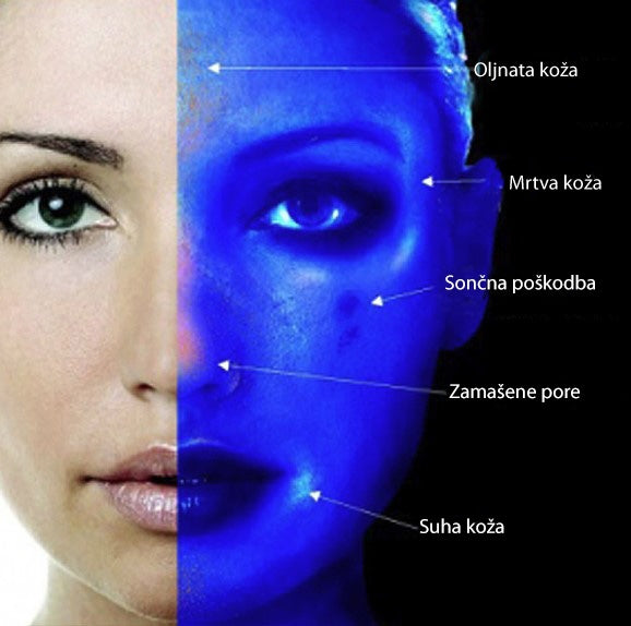 Wood-jeva svetilka (Wood's Lamp) Fox-1004 | Diagnos |